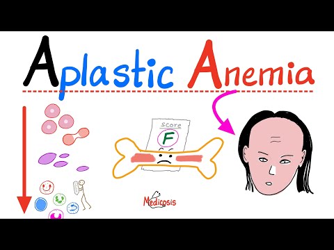 Aplastic Anemia; All you need to know (Definition, Causes, Clinical Picture, Diagnosis& Management)