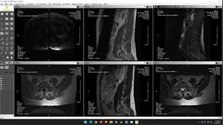 How to link views for MRI and CT exams in AmplifyPACS