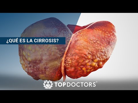 Video: ¿Dónde afecta la cirrosis?