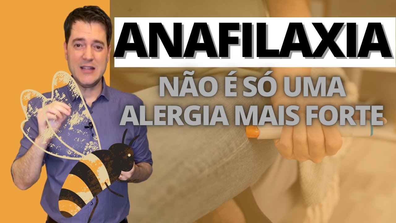 ANAFILAXIA NÃO É SÓ UMA ALERGIA MAIS FORTE