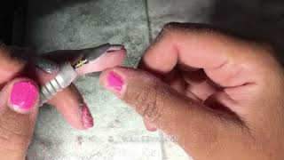 Mellow Yellow Gel Removal Bit - Atwood Industries