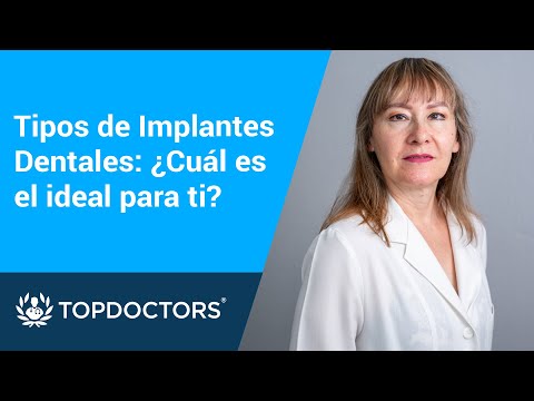 Tipos de Implantes Dentales: ¿Cuál es el mejor para ti?