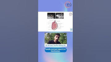 What is the best way to apply stem cells & exosomes?