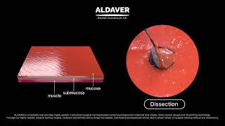 ESD (Endoscopic Submucosal Dissection) Simulator - ALDAVER Surgical Simulator