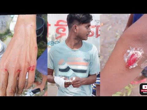 শুভ কাজটা ঈদের দিন সারলাম 😞💔