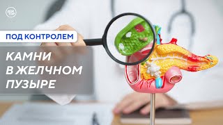 Когда необходимо удалять желчный пузырь / Под контролем