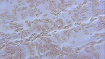 OMAX Video Demo 2 of fresh flowing human blood at (40x)