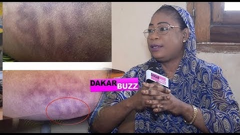 Miraculeux Aissatou Penda Diop voyante révèle la multiplication des noms de Dieu sur son corps