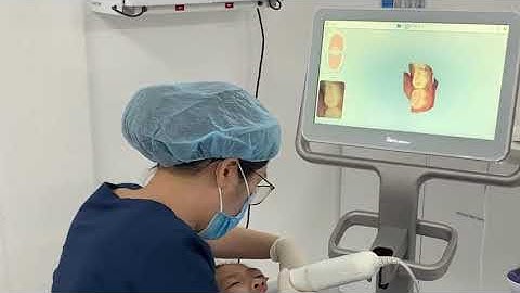 Giới thiệu Máy Quét Itero 5D Plus | Nha Khoa Hoàn Mỹ Bảo Lộc