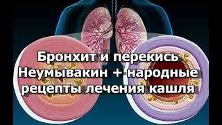 Бронхит и перекись - Неумывакин + народные рецепты лечения кашля видео Чем лечить бронхит: лекарства и народные методы