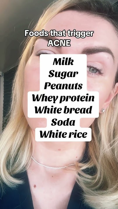 Did You Know That There Are Some Foods That Trigger Acne acne did-you-know-that-there-are-some-foods-that-trigger-acne-acne