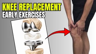 Total Knee Replacement Recovery: What to Expect & 5 Early Exercises
