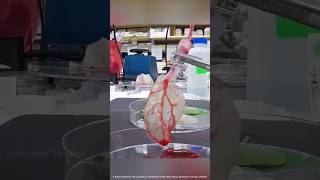 This Spinach Leaf Could Replace a Human Heart! | #shorts