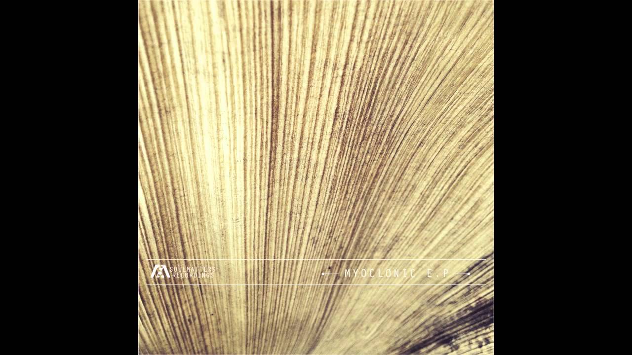 Watch Notion A - Unsure on YouTube Watch Notion A - Unsure on YouTube