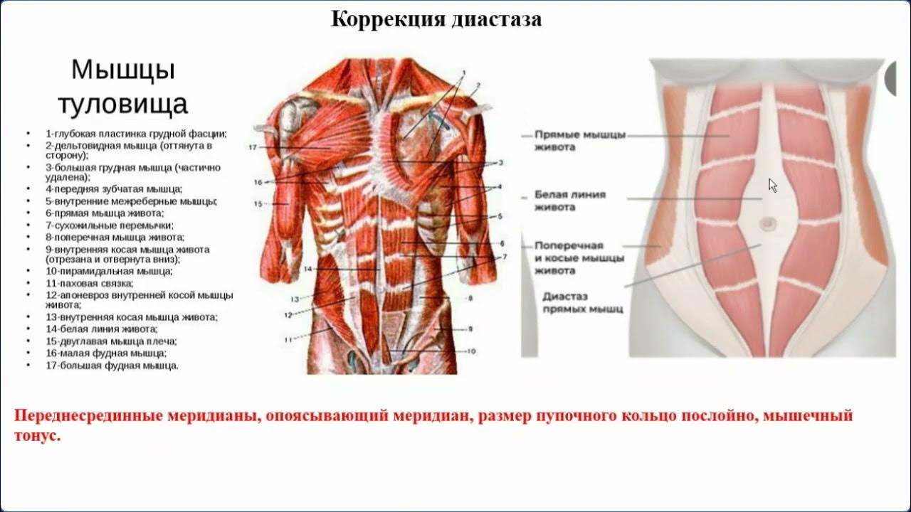 упражнения при диастазе мышц живота. диастаз мышц мкб. диастаз мышц живота код по мкб 10. наружная косая мышца живота. диастаз прямых мышц живота кт.