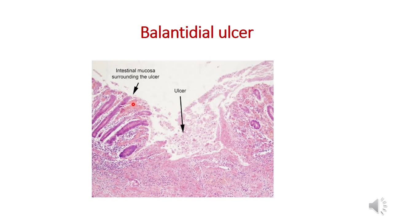 Protozoan Parasitology - Lec 3 Part ONE
