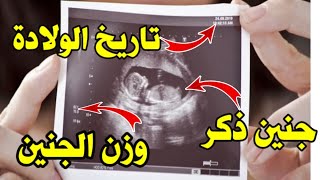 كيف تعرفي جنس الجنين ووزن الجنين و موعد الولادة من ورقة السونار، تعلمي قراءة الس