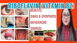 Riboflavin: Vitamin B2 | Benefits, Deficiency, Symptoms and how it is treated