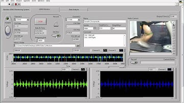 Wireless System for sEMG Detection