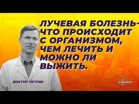 Лучевая болезнь. Что происходит с организмом. Чем лечить и можно ли выжить.