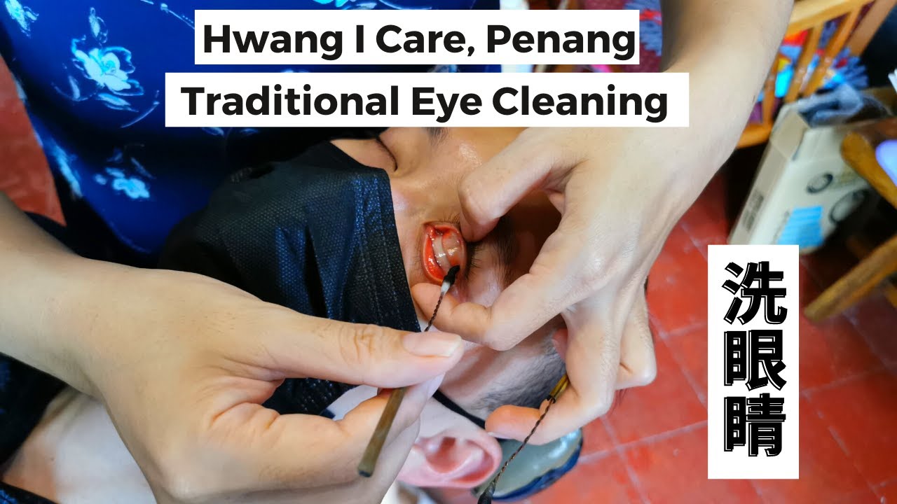 Traditional Eye Cleaning, Penang 槟城传统洗眼睛 YouTube