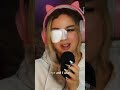 HOW I nearly LOST MY EYE | ER Story Time / Finnish Girl Reacts