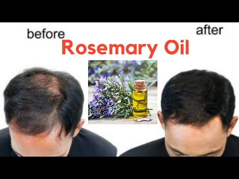 How To Use Rosemary Essential Oil For Hair Growth 30-Day Challenge