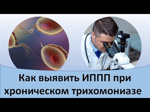 Как выявить ИППП