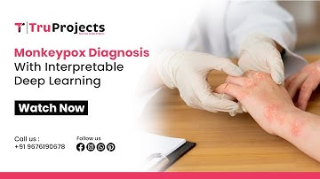 Monkeypox Diagnosis With Interpretable Deep Learning