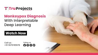 Monkeypox Diagnosis With Interpretable Deep Learning