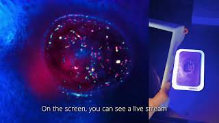 Multispectral imaging for wound monitoring - Spectricity