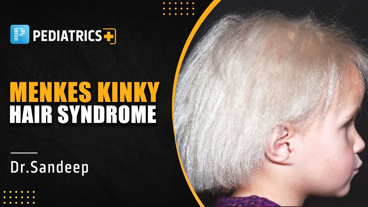 MENKES Kinky Hair DISEASE Symptoms Causes Signs Treatment  What is Menkes  Disease  YouTube