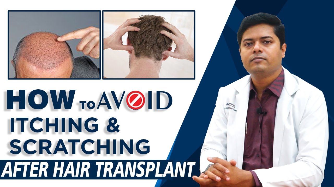 How To Avoid Itching & Scratch After Hair Transplant | Hair Transplant  केबाद सिर खुजली से कैसे बचें? - YouTube