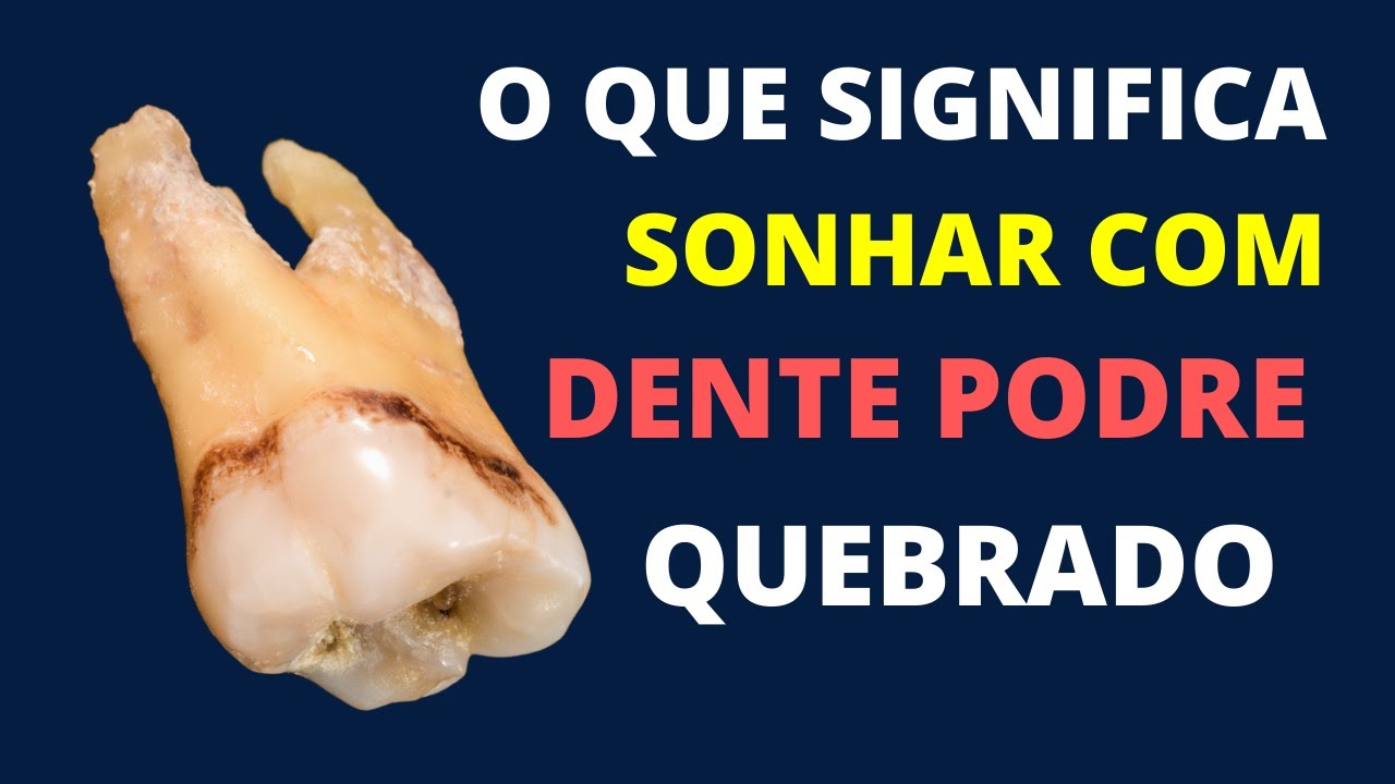 Sonhar com dente podre e quebrado - Saiba o significado! - YouTube