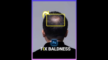 How to fix baldness in photoshop 2025.#photoshop #photoshop_tutorial