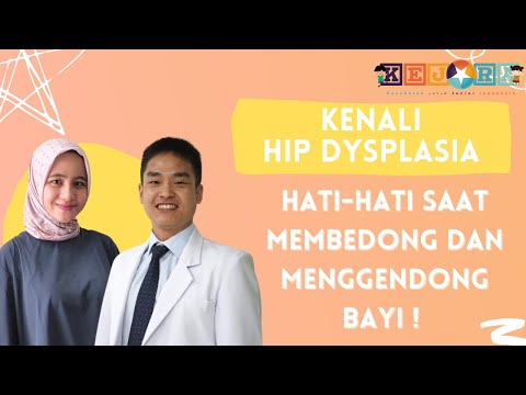 Kenali Hip Dysplasia/displasia panggul pada bayi : Hati-hati saat bedong dan gendong bayi!