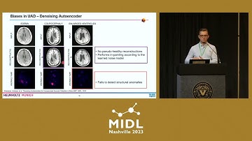 Generalizing Unsupervised Anomaly Detection: Towards Unbiased Pathology Screening. #MIDL2023.