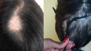 COMO FAZER BASE PARA COLOCAR MEGA HAIR EM CABELO COM FALHAS