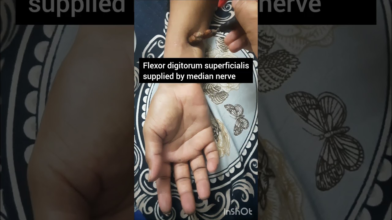 Stroke Alert! nerve stimulation 