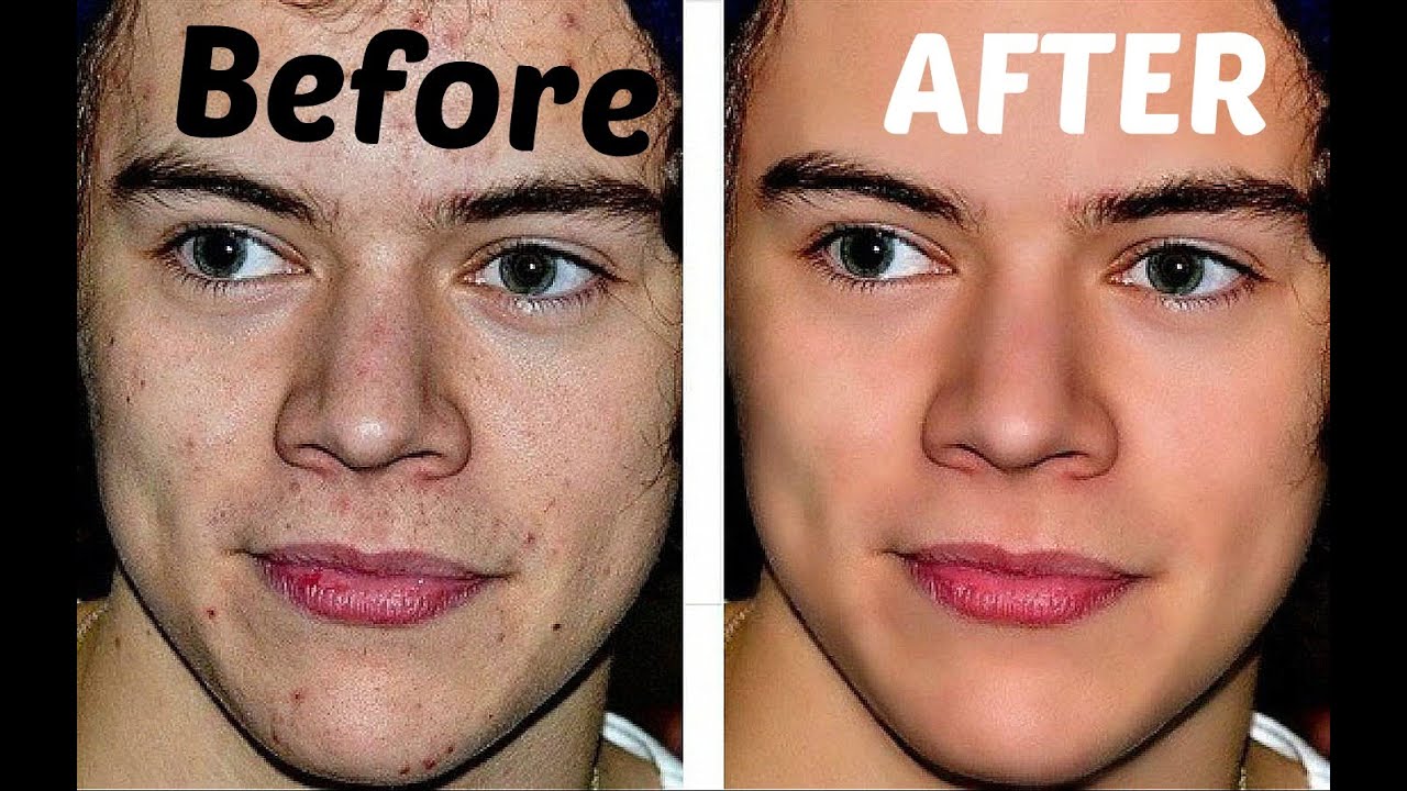 Harry styles Before and after - YouTube.