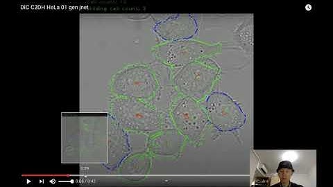 Cell Segmentation and Tracking