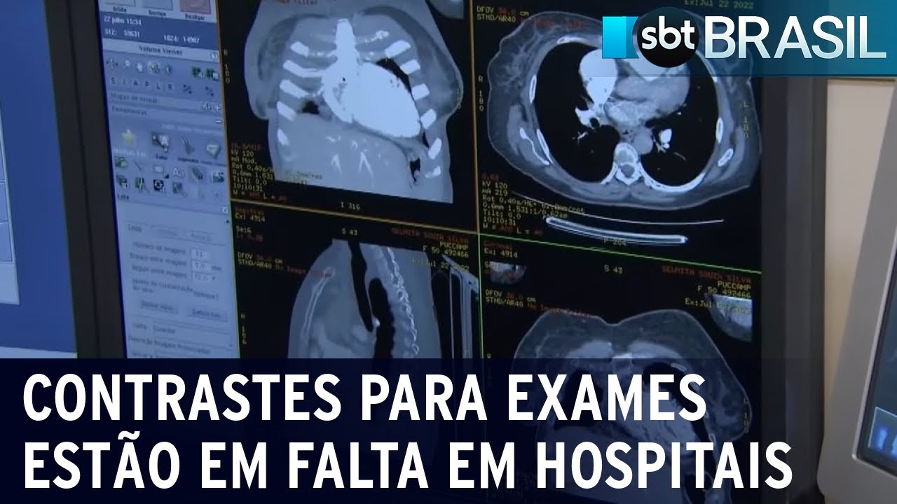 Contrastes para exames estão em falta em hospitais no país | SBT Brasil (22/07/22)