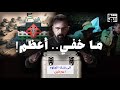 بنك الجلد البشري حسن هاشم 