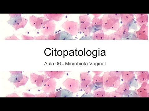 Vídeo: Traduzindo O Microbioma Vaginal: Lacunas E Desafios