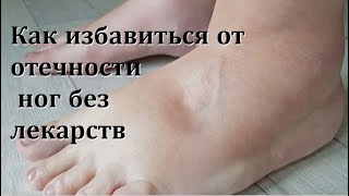 Как избавиться от отечности ног без лекарств
