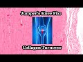 Jumper’s Knee: Collagen Turns Over Fast (Fix Patellar Tendinopathy)