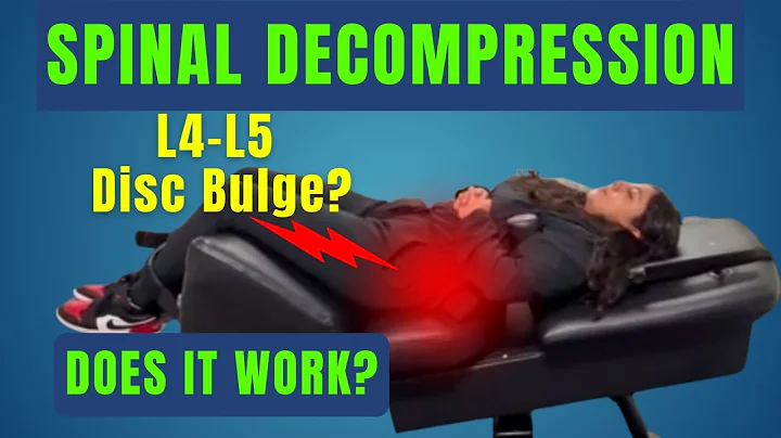 L4-L5 Disc Bulge: Does Non-Surgical Spinal Decompression ACTUALLY WORK? | Dr. Kevin Wafer