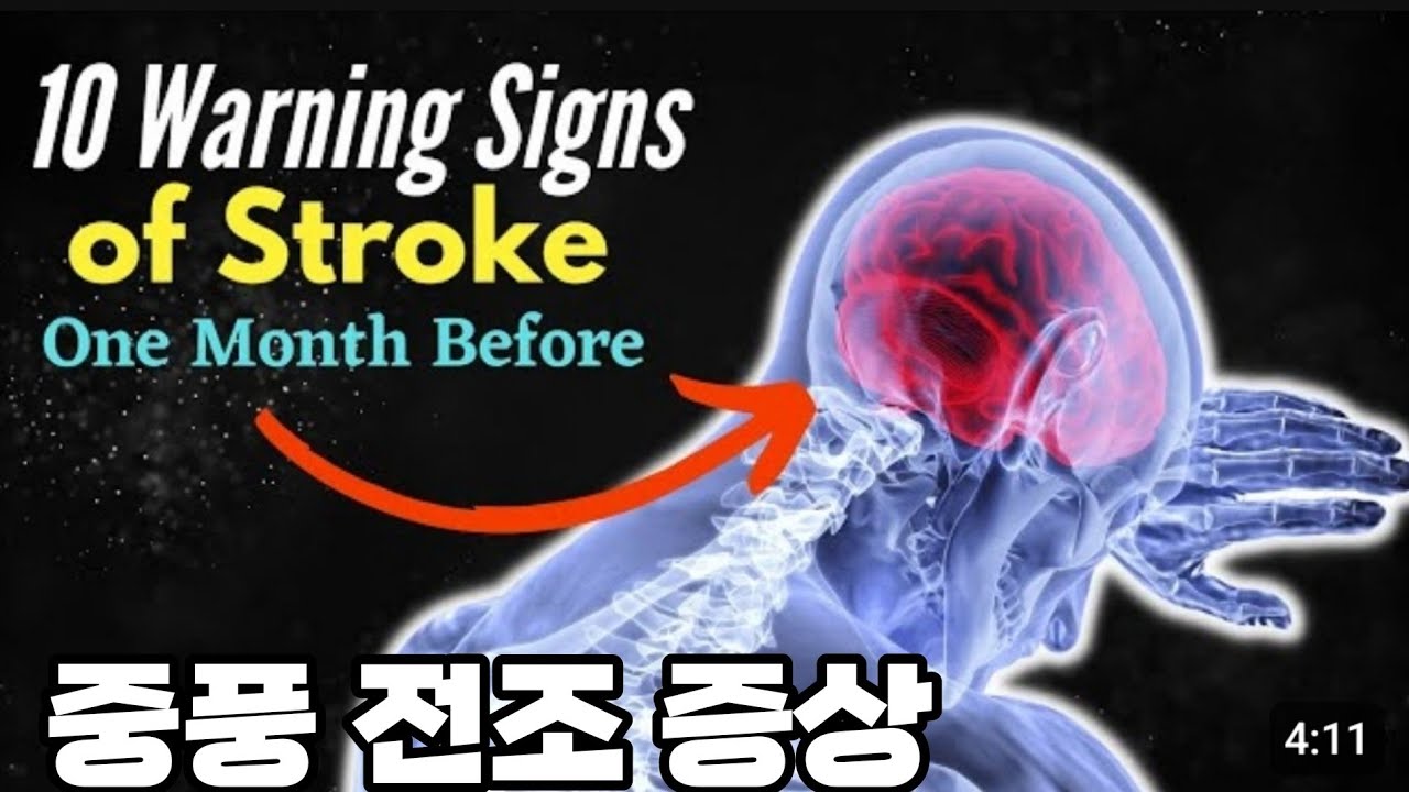 Premonitory Symptoms Before A Stroke YouTube Premonitory Symptoms Before A Stroke YouTube