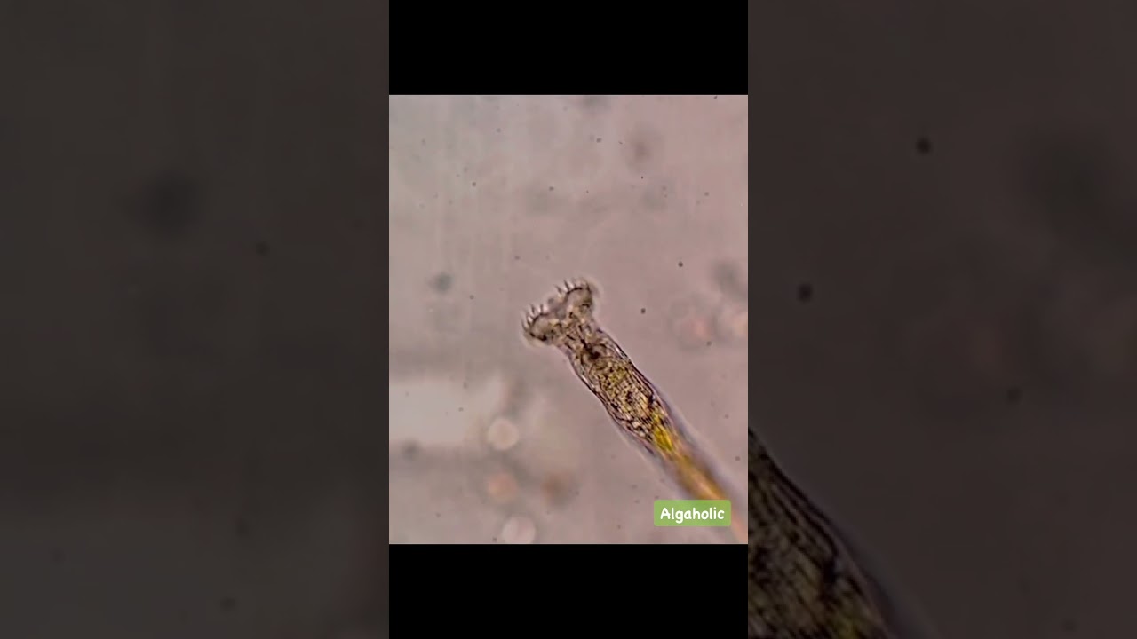 A kind of rotifer. Rotifera sp. or Philodina sp.? 