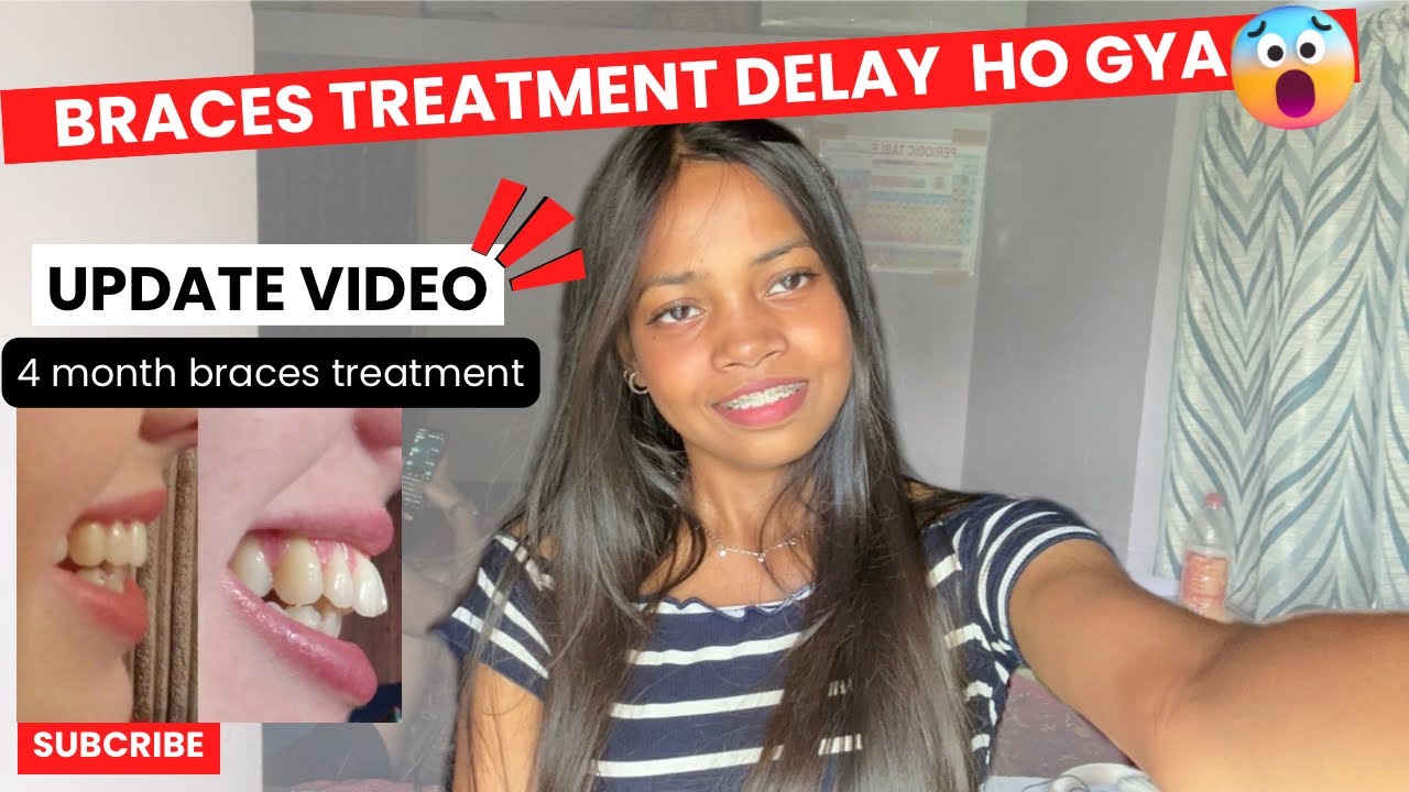 *BRACES TREATMENT DELAY HO GYA* | monthly update video | metal braces |